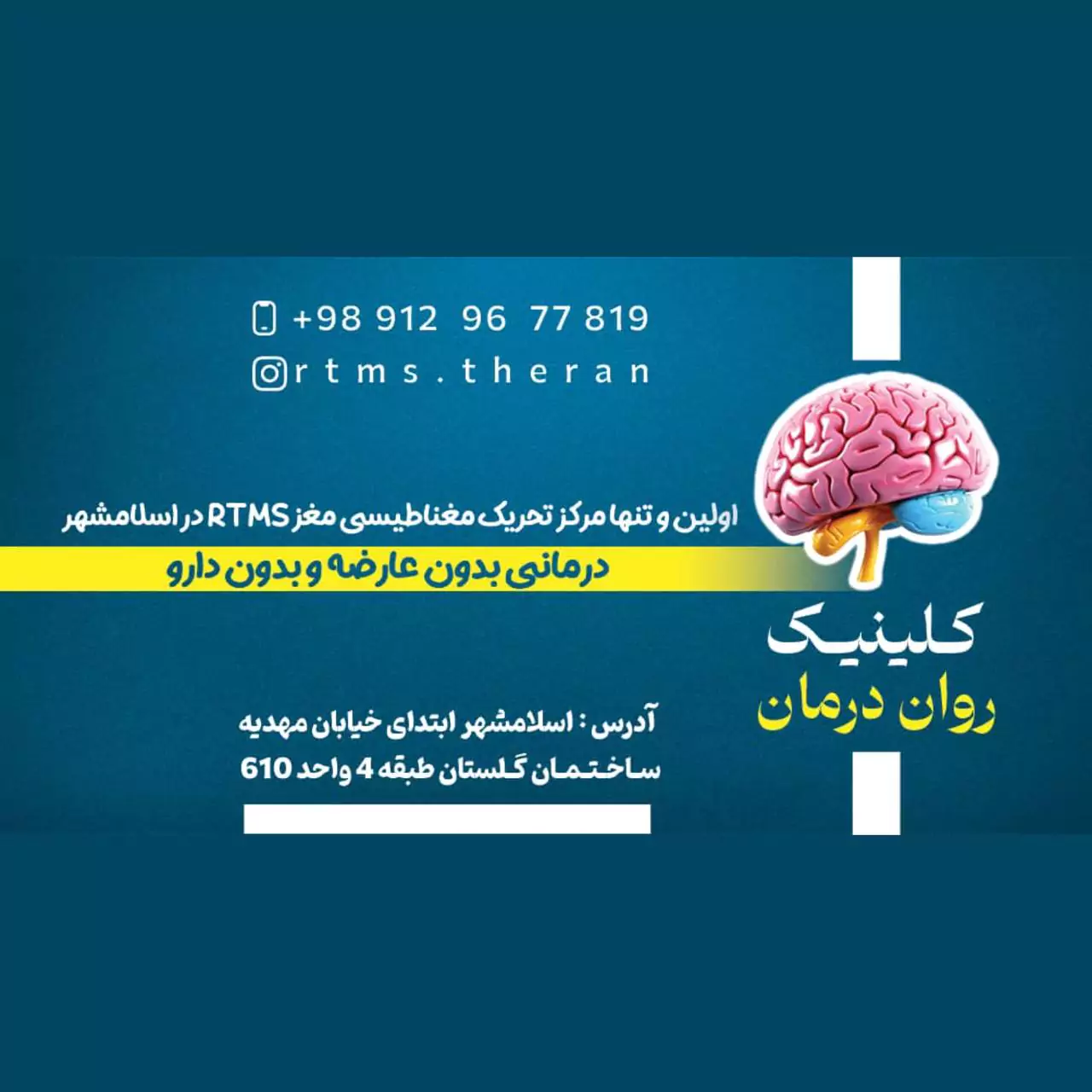 آر تی ام اس ( rtms ) در اسلامشهر