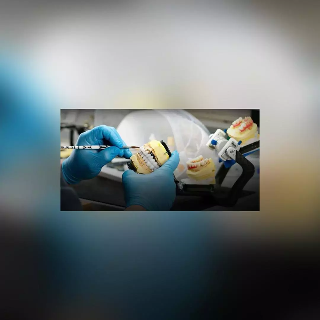بهترین لابراتوار دندانسازی در عظیمیه کرج