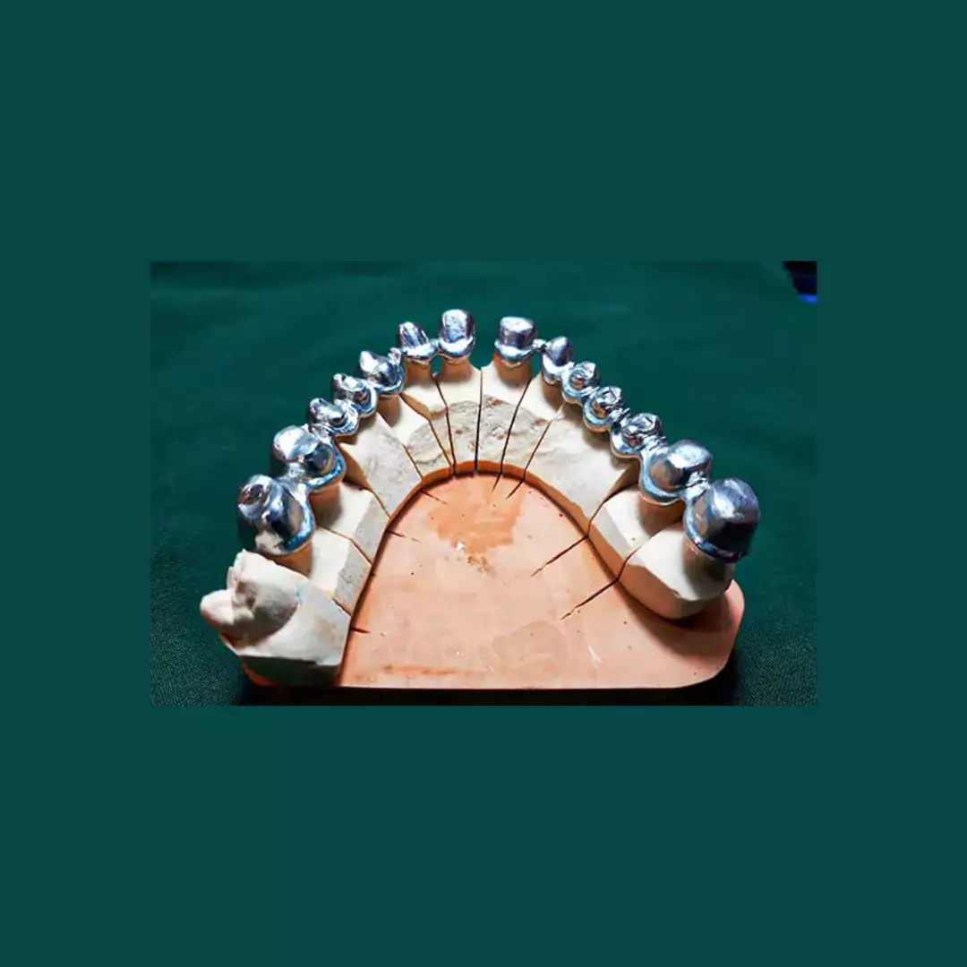 بهترین لابراتوار دندانسازی در واوان