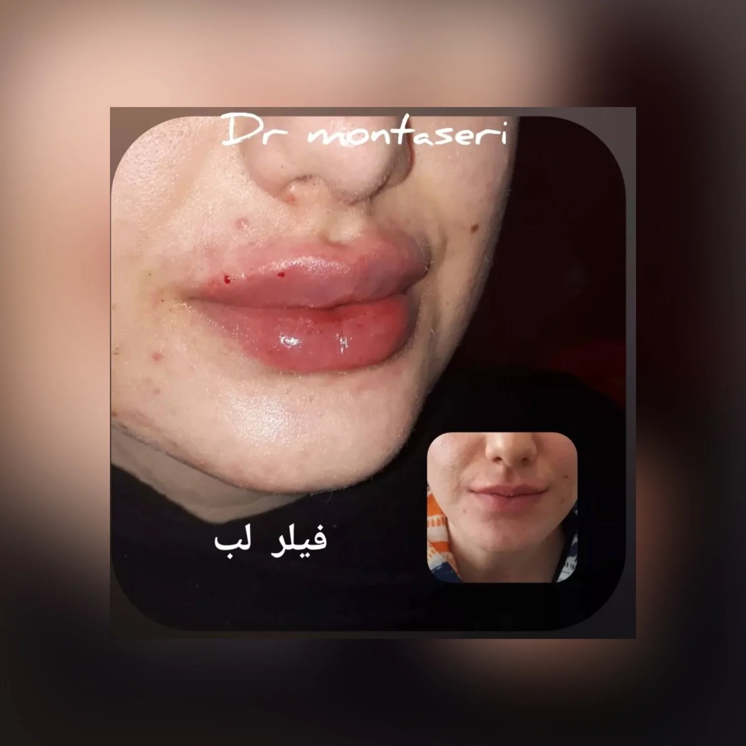 پزشک زیبایی دکتر منتصری