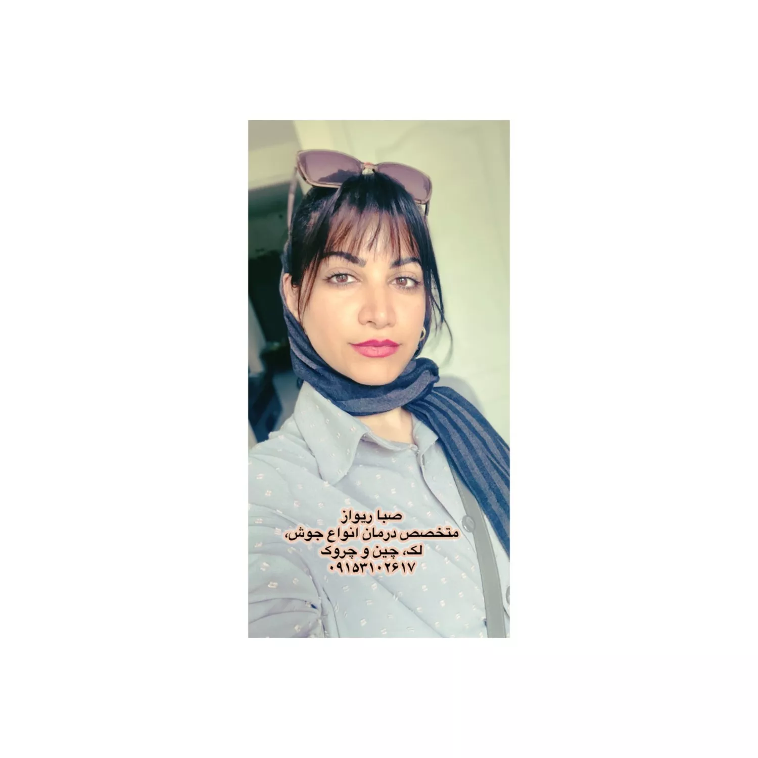 اسکین کر صبا