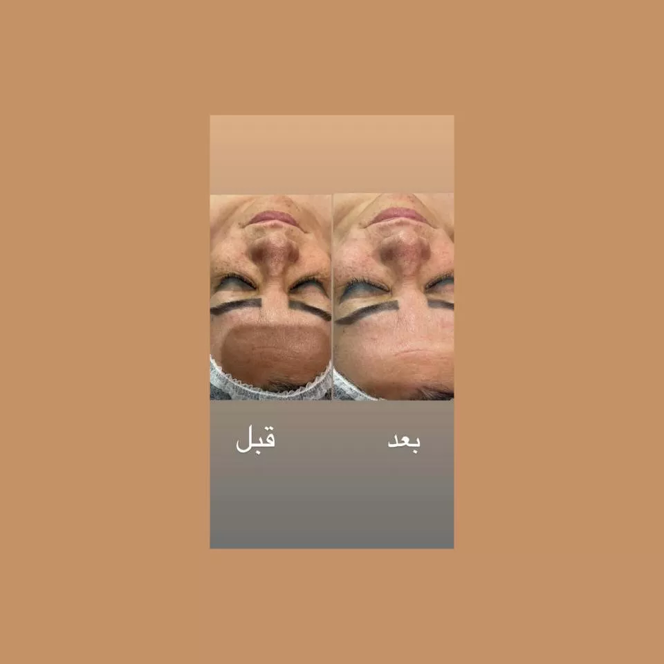 اسکین کر سمیرا صادقی